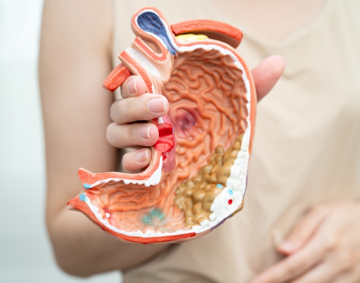 Signs of Colon Cancer in Women: Symptoms & Screening